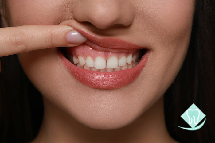 Top Benefits of Preventive Dentistry Services for Families
