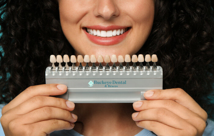 5 Ways Cosmetic Dentistry Builds Confidence