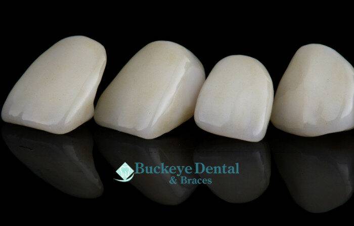 Local Experts in Cosmetic Dentistry