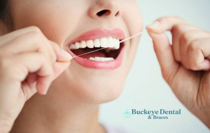 Don’t Skip Flossing