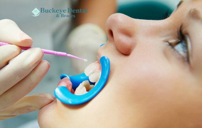 Protect Your Teeth From Wear, Injury, and Stress