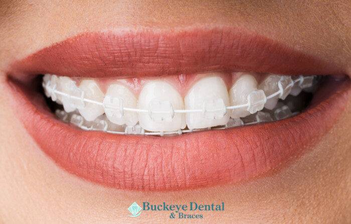 Makes Buckeye Dental & Braces Unique