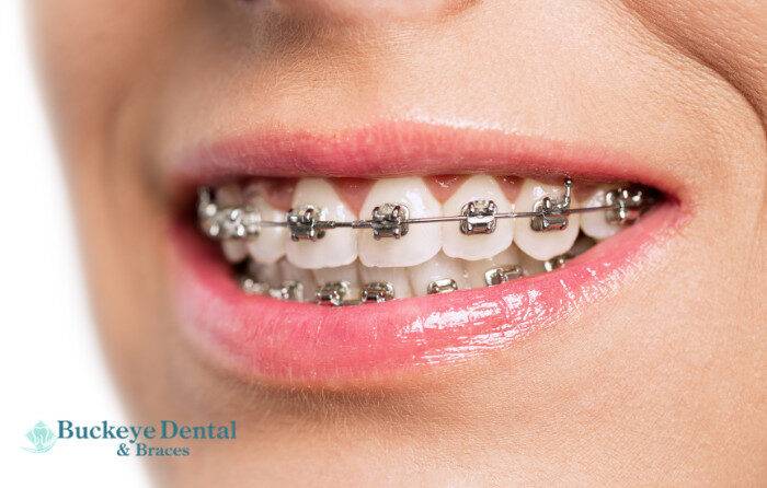 Pediatric Services at Buckeye Dental & Braces