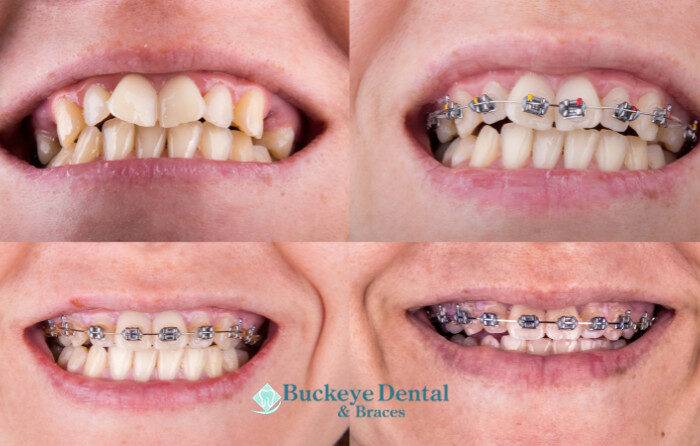 Important Considerations Before Treatment