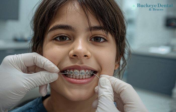 Long Does Braces Treatment Take