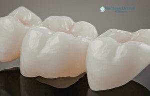 Stop Cavities in 2026 With Expert Preventative Dentistry Services