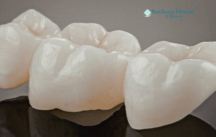 Stop Cavities in 2026 With Expert Preventative Dentistry Services