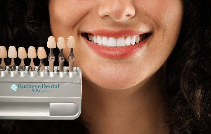 Top Cosmetic Dentistry Services Ohio Patients Request