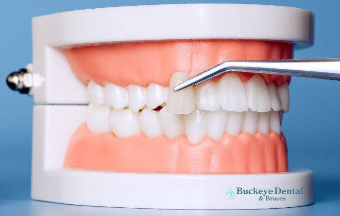 Trends Driving Cosmetic Dentistry in Ohio This Year