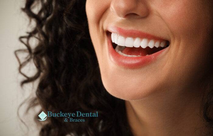 Types of Cosmetic Dentistry Services