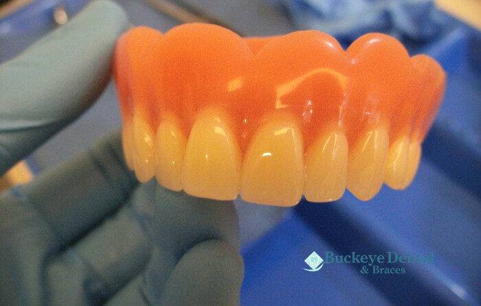 Why Preventive Dentistry Matters