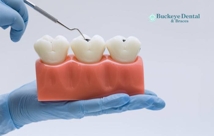 Children and Preventive Dentistry