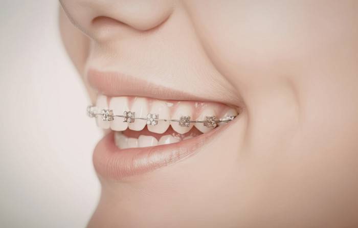 How Buckeye Dental and Braces Helps With Urgent Tooth Pain