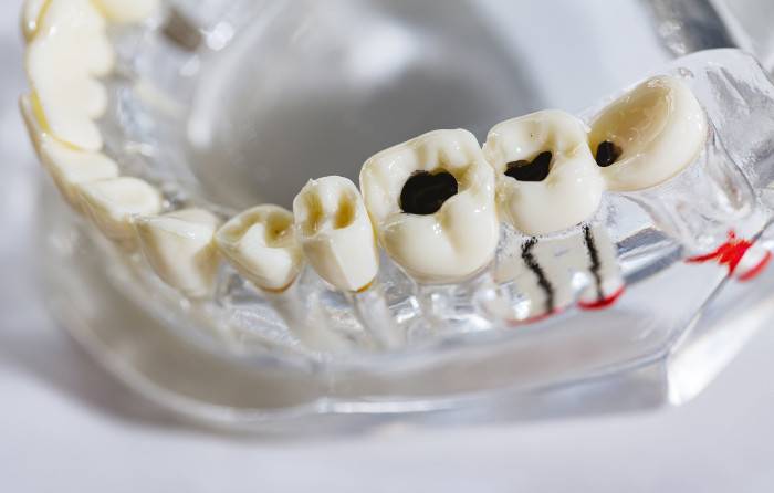 Common Dental Problems and How to Prevent Them