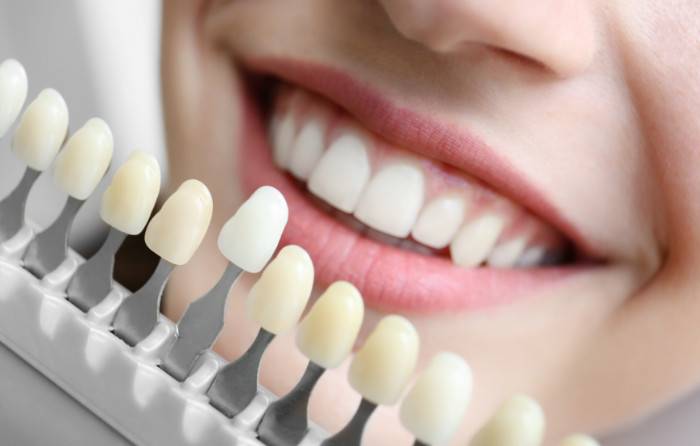 The Benefits of Choosing a Trusted Local Dental Office