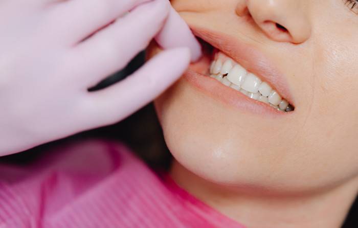 Tooth Sensitivity