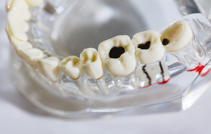 How Can Parents Prevent Common Dental Problems