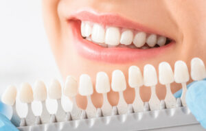 Do You Need a Dental Crown or a Filling How to Know Which Is Right for You