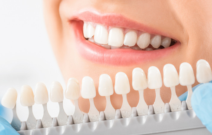 Do You Need a Dental Crown or a Filling How to Know Which Is Right for You