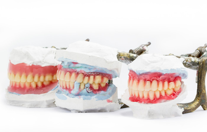 Types of Full Dentures