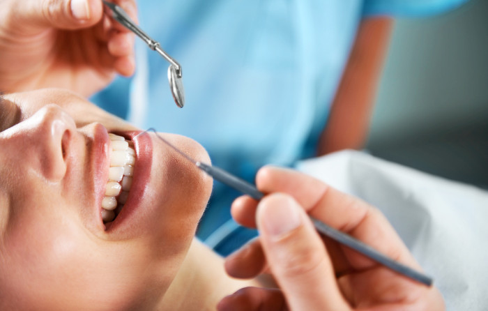 What Is a Dental Filling